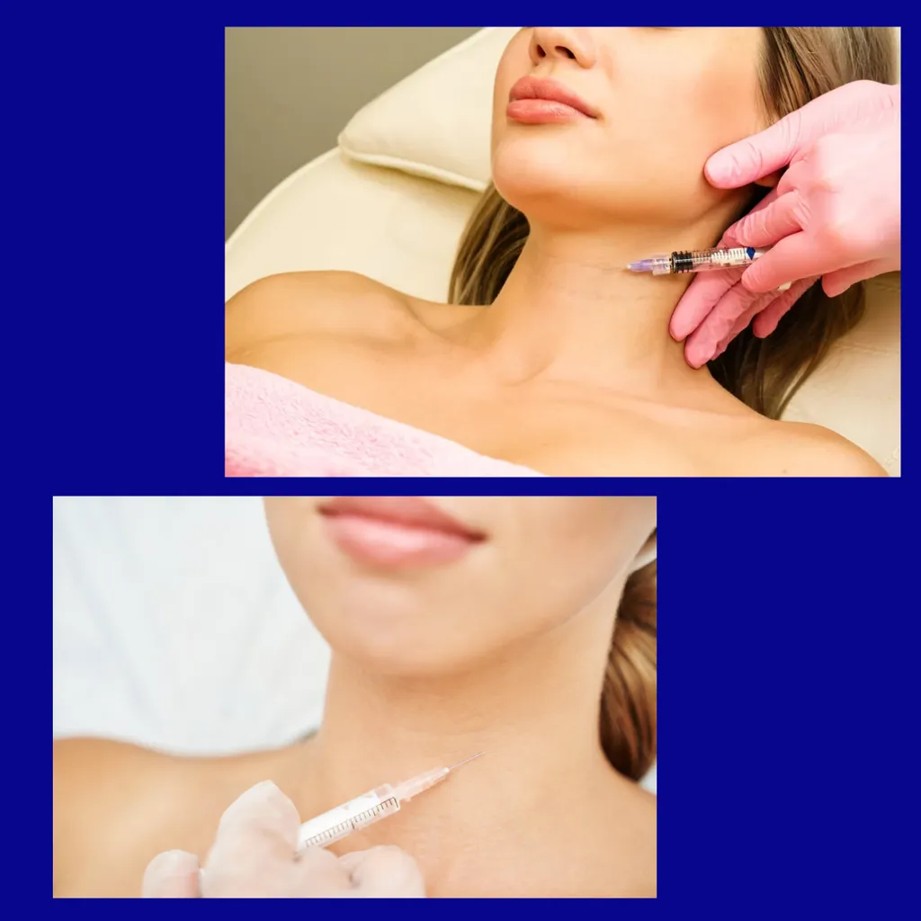 Neck Platysmal Bands (Neferititi Neck Lift)