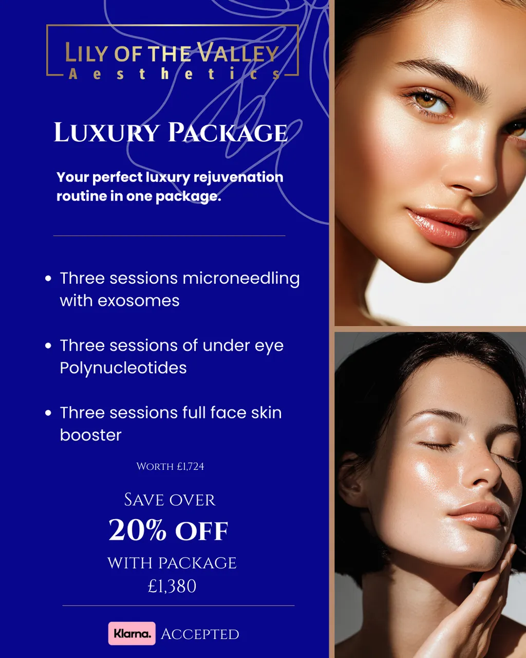 Luxury Package