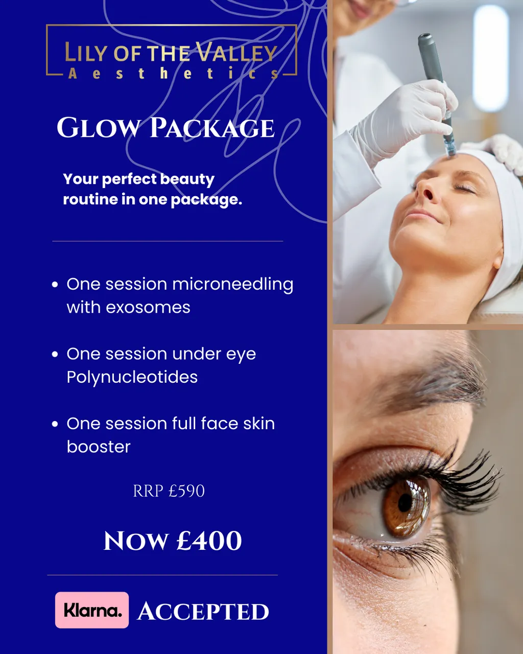 Glow Package